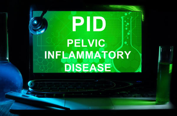 PID Pelvic Inflammatory Disease
