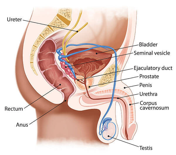 Male Infertility