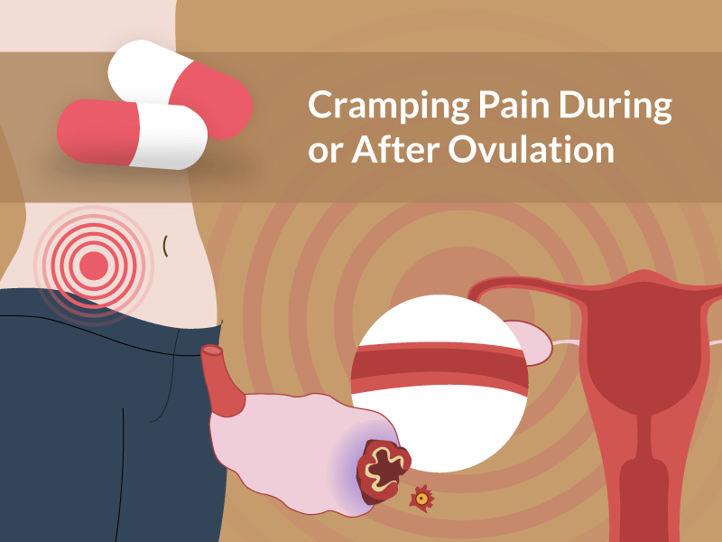 Cramping Pain During or After Ovulation? Are You Pregnant?