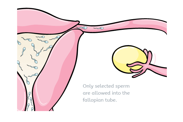 How long can sperm live inside vagina