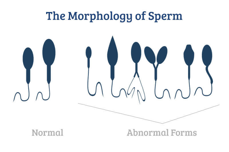 Morphology of sperm