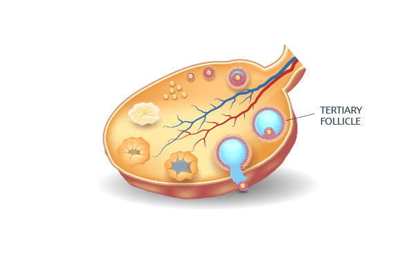 Tertiary follicles