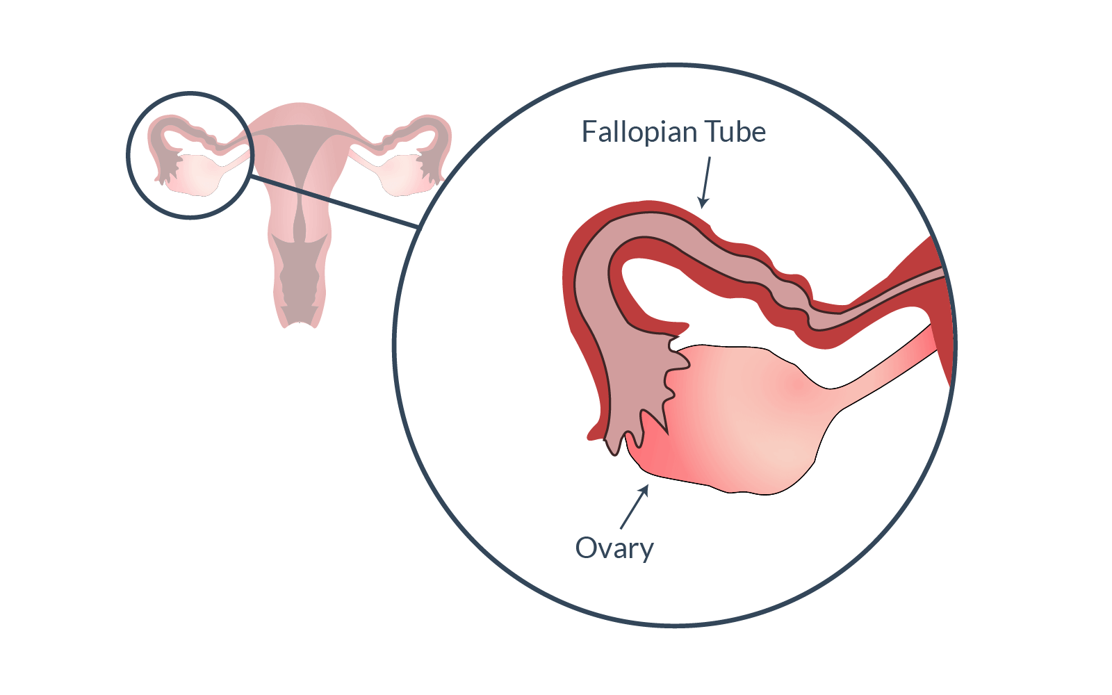 Fallopian tube and ovary