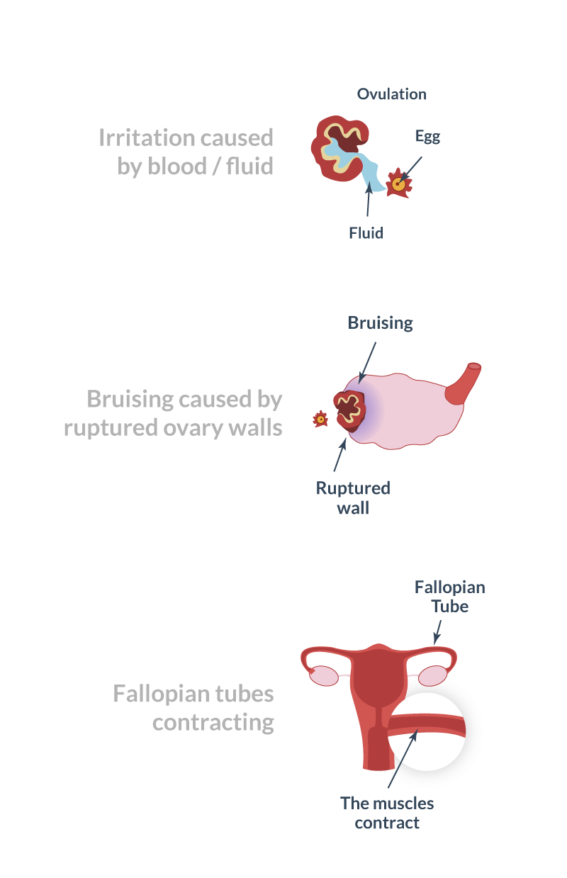 Ovulation pain cause by theories