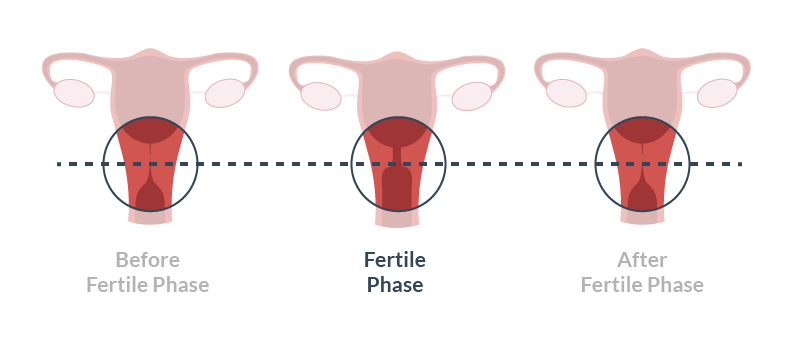 Typical pattern of cervix changes you can expect to observe