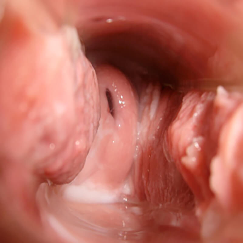 Cervix Day 21