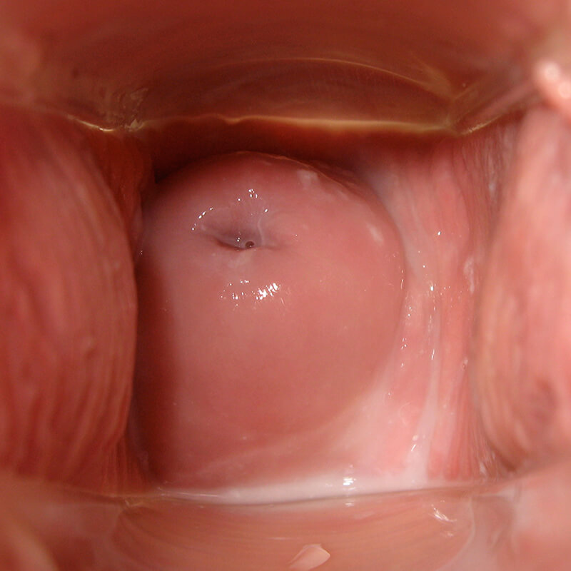 Cervix Day 29