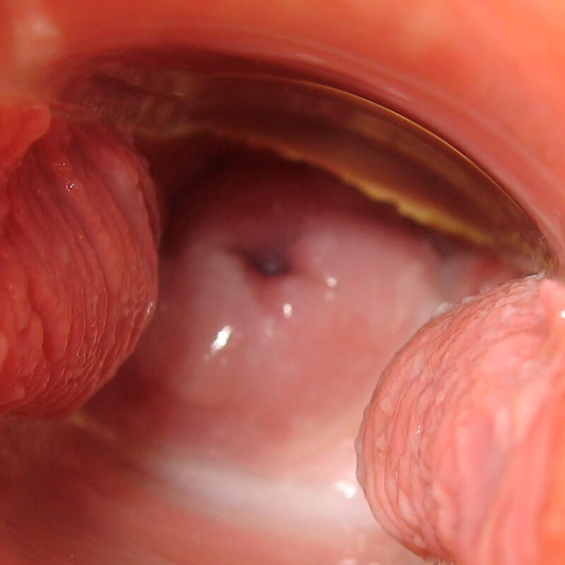 Cervix Day 7