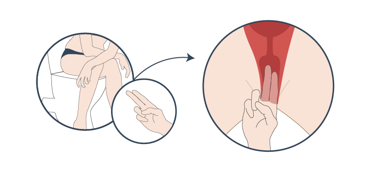 Locate your cervix by sitting on an open toilet and inserting your index and middle fingers into your vagina to touch your cervix