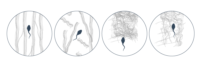 Structure of cervical mucus presents a barrier to sperm