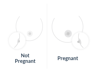 Pregnancy sign, color of nipples changes