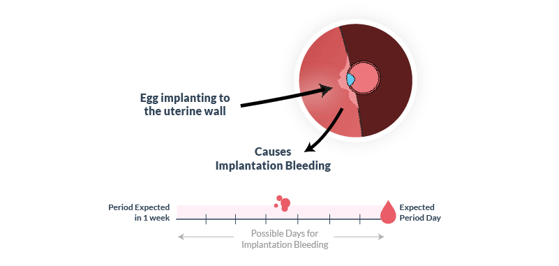 Signs of pregnancy, spotting (implantation bleeding)