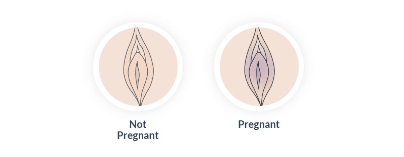 Signs of pregnancy, vulva color changes